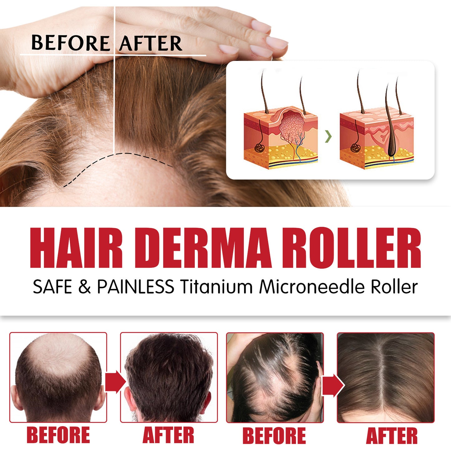 Hair Roller