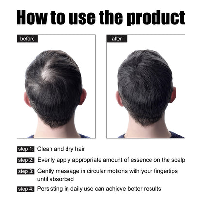 Hair Growth Promotion Essence