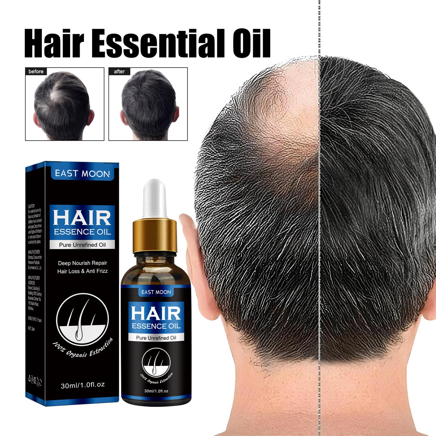 Hair Growth Promotion Essence