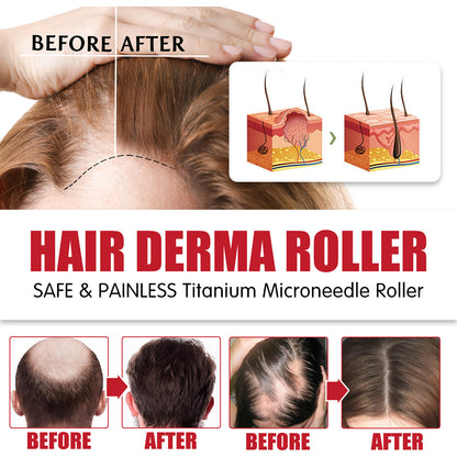 Hair Roller