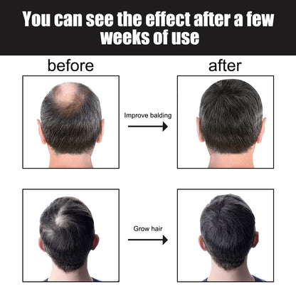 Hair Growth Promotion Essence