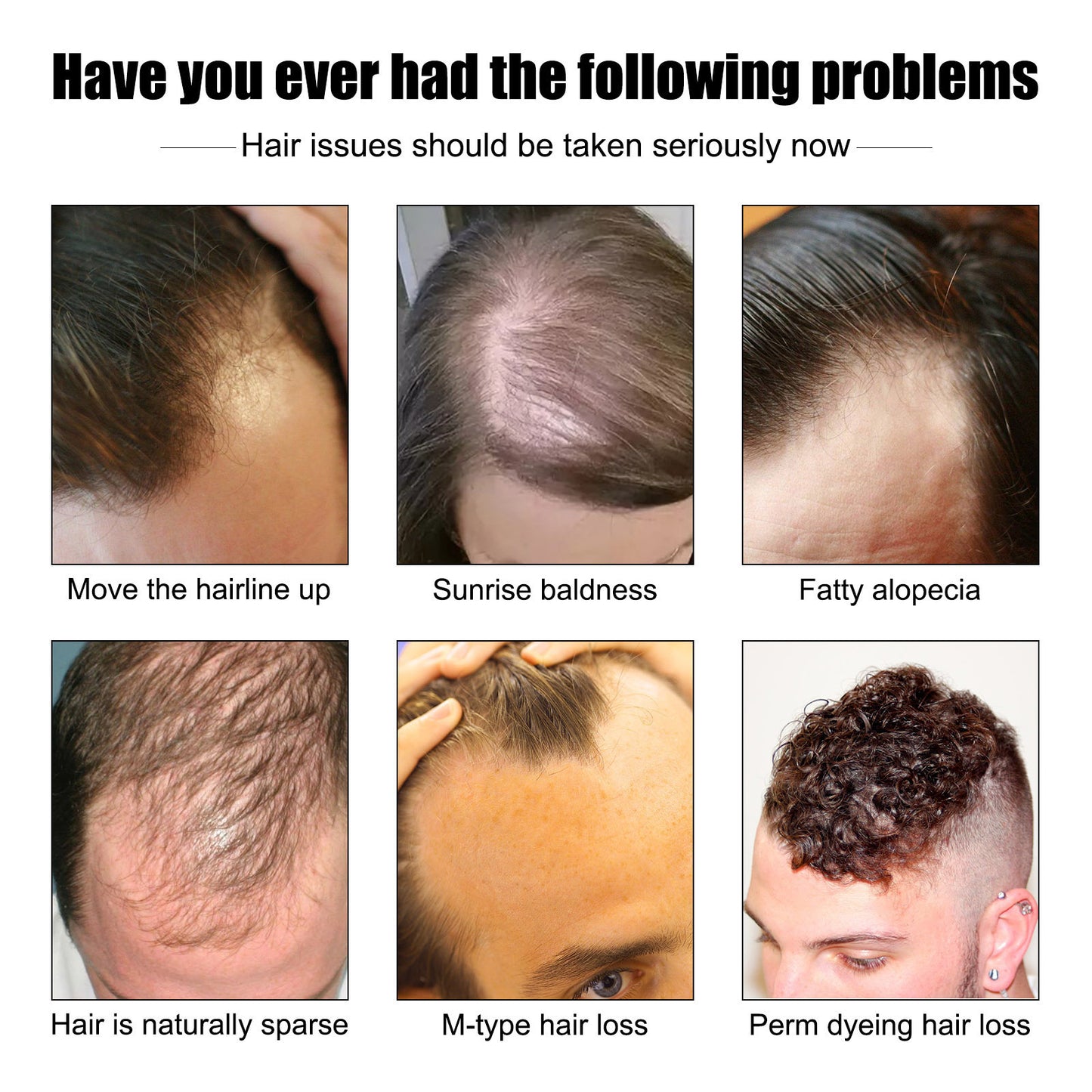 Hair Growth Promotion Essence